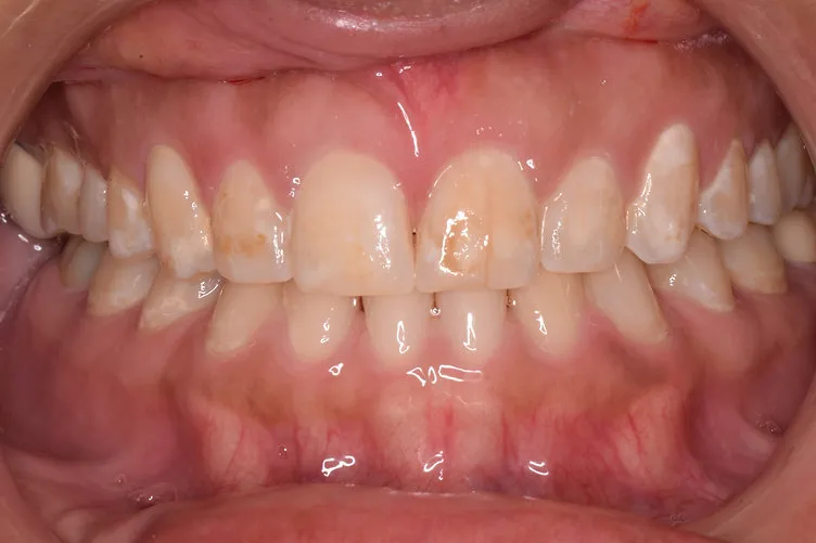 Before dental treatment